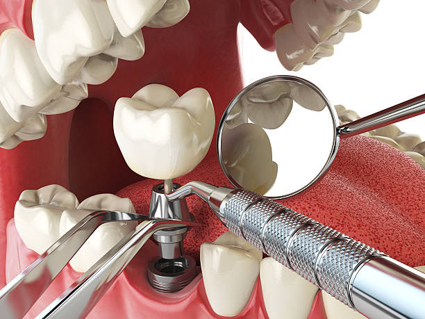 Best Emergency TMJ Treatment in Murillo, TX